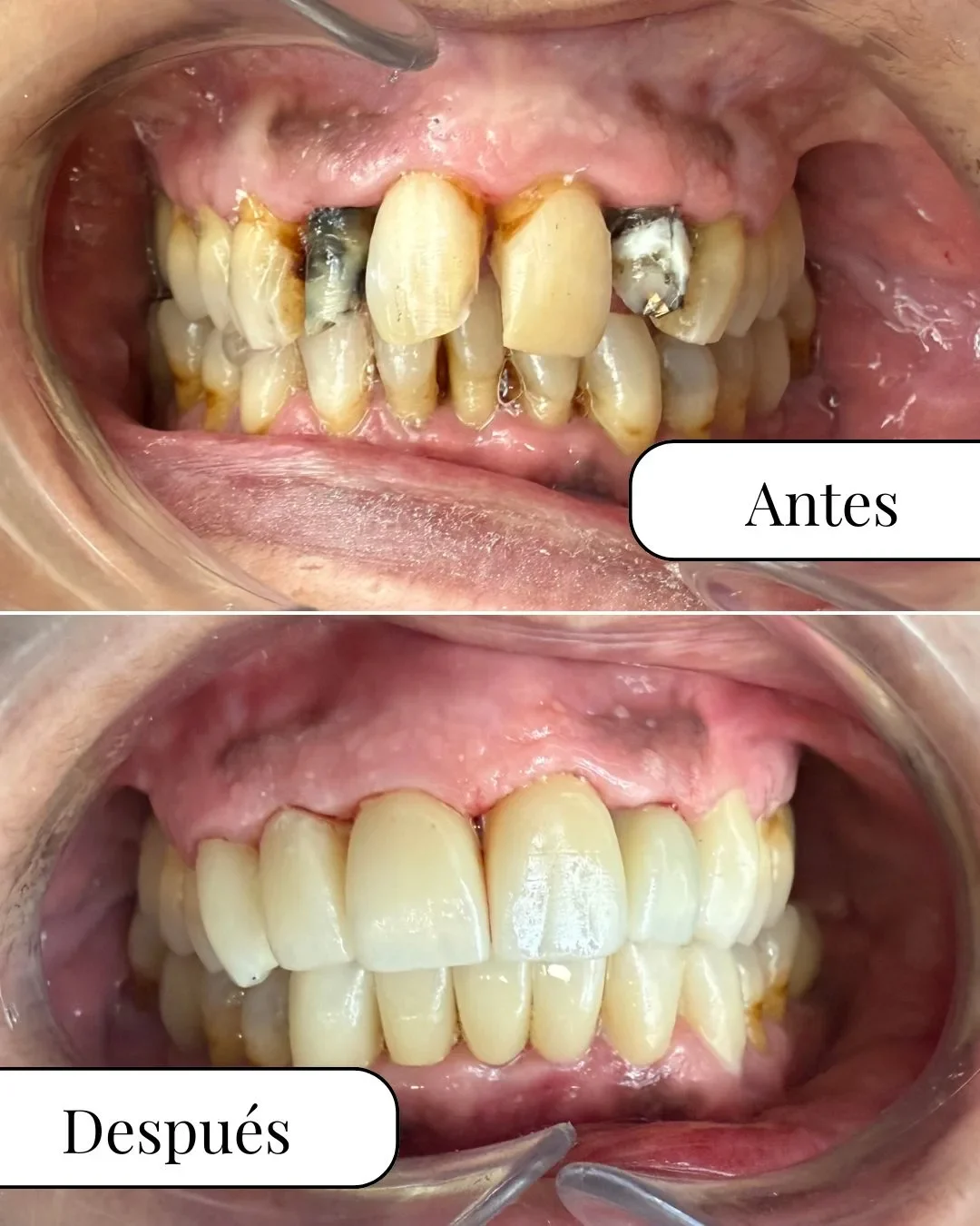 andrea odontologa rehabilitaciones dentales